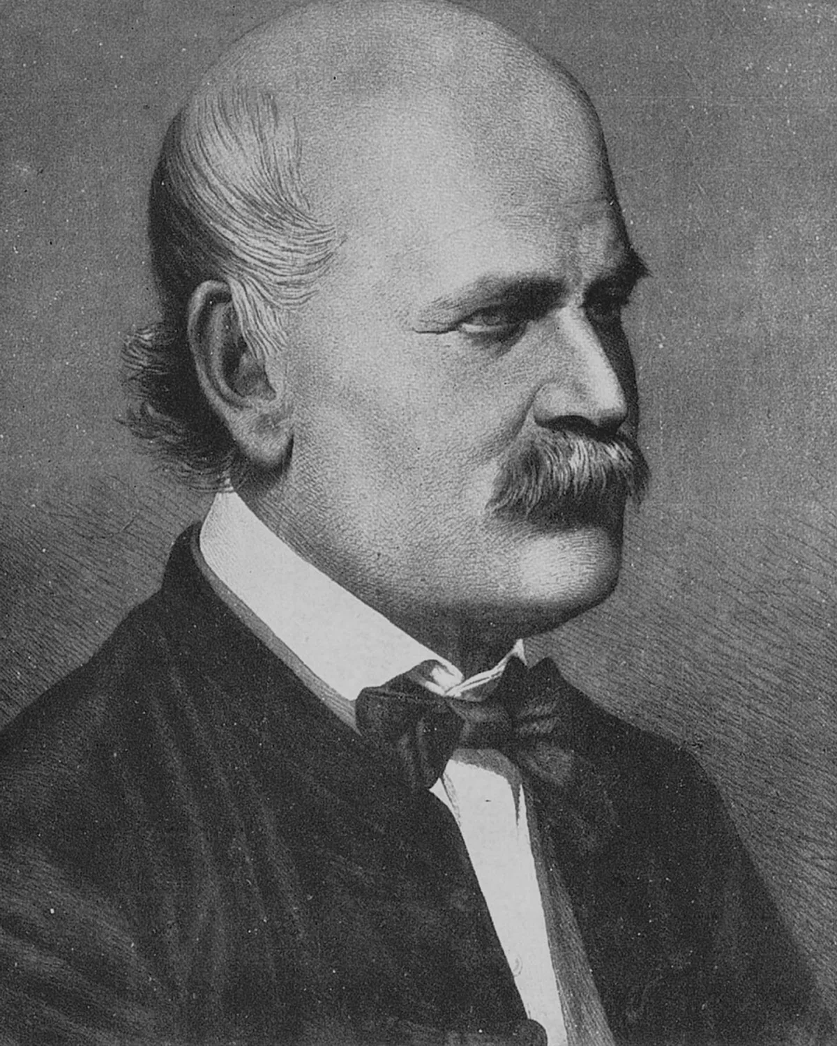 A nineteenth-century portrait of Ignaz Semmelweis